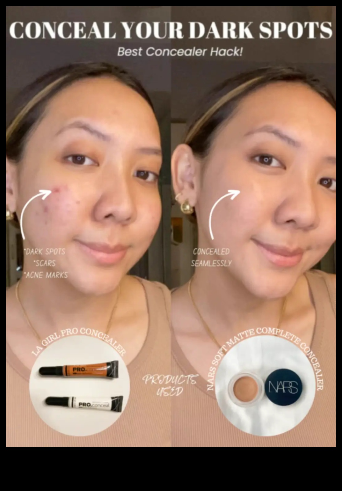 Ruj și disimulare: imperfecțiuni de camuflare pentru un aspect impecabil